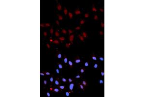 Immunofluorescence analysis of U2OS cells using Phospho-Stat3-Y705 antibody (ABIN5969916). (STAT3 抗体  (pTyr705))