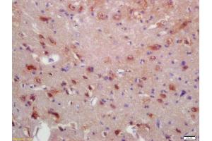 Formalin-fixed and paraffin embedded rat brain labeled with Anti-MRF/C11orf9 Polyclonal Antibody, Unconjugated (ABIN1386454) at 1:200 followed by conjugation to the secondary antibody and DAB staining (Chromosome 11open Reading Frame 9 (C11orf9) (AA 401-500) 抗体)