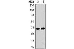 Western blot analysis of Tropomyosin 3 expression in mouse lung (A), mouse heart (B) whole cell lysates. (TPM3 抗体)