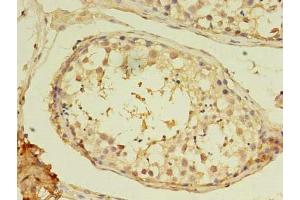 Immunohistochemistry of paraffin-embedded human testis tissue using ABIN7160592 at dilution of 1:100 (MYH7B 抗体  (AA 1-176))