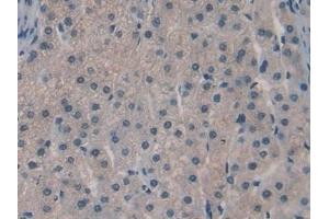 Detection of SPRY3 in Human Liver Tissue using Polyclonal Antibody to Sprouty Homolog 3 (SPRY3) (SPRY3 抗体  (AA 91-288))