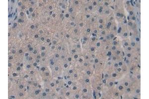 Detection of SPRY3 in Human Liver Tissue using Polyclonal Antibody to Sprouty Homolog 3 (SPRY3)