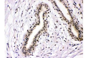 Immunohistochemistry (IHC) image for anti-Nuclear Factor I/A (NFIA) (AA 180-224), (Middle Region) antibody (ABIN4886680)