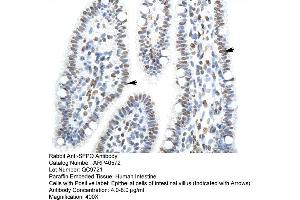 Rabbit Anti-SFPQ Antibody  Paraffin Embedded Tissue: Human Intestine Cellular Data: Epithelial cells of intestinal villas Antibody Concentration: 4. (SFPQ 抗体  (N-Term))
