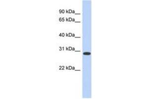 Image no. 1 for anti-Homeobox D12 (HOXD12) (AA 179-228) antibody (ABIN6742239) (HOXD12 抗体  (AA 179-228))