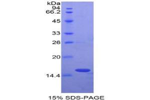 SDS-PAGE analysis of Rat Oncomodulin Protein. (Oncomodulin Protein (OCM))