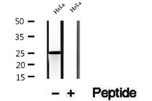 Western blot analysis of extracts of HeLa cells, using CHCHD6 antibody.
