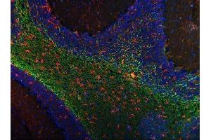 IF analysis of GFAP and MAG using anti-GFAP antibody and anti-MAG antibody (ABIN7601399).