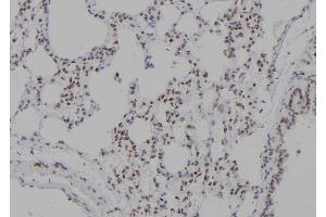 ABIN6277236 at 1/100 staining Rat lung tissue by IHC-P. (TCOF1 抗体  (N-Term))