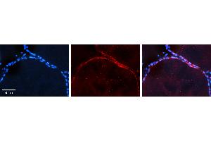 Rabbit Anti-AKT2 Antibody   Formalin Fixed Paraffin Embedded Tissue: Human Thyroid Tissue Observed Staining: Plasma membrane in follicular cells Primary Antibody Concentration: 1:100 Other Working Concentrations: 1:600 Secondary Antibody: Donkey anti-Rabbit-Cy3 Secondary Antibody Concentration: 1:200 Magnification: 20X Exposure Time: 0. (AKT2 抗体  (Middle Region))