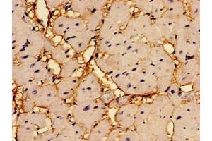 Immunohistochemistry of paraffin-embedded human heart tissue using ABIN7167601 at dilution of 1:100