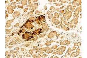 ABIN7094242 and ABIN7098289 at 1/100 staining Human normal tissues adjacent to esophageal cancer by IHC-P.