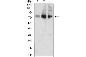 Western blot analysis using ACSS1 mouse mAb against MOLT4 (1), Jurkat (2), and HL-60 (3) cell lysate. (ACSS1 抗体  (AA 548-689))