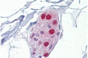 Immunohistochemistry (IHC) image for anti-Nuclear Receptor Subfamily 3, Group C, Member 1 (Glucocorticoid Receptor) (NR3C1) (AA 180-229) antibody (ABIN6748602)