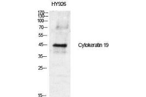 Western Blot (WB) analysis of specific cells using Cytokeratin 19 Polyclonal Antibody. (Cytokeratin 19 抗体  (Internal Region))