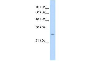 WB Suggested Anti-UBE2J2 Antibody Titration:  1. (UBE2J2 抗体  (C-Term))