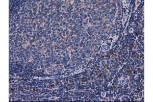 Image no. 1 for anti-Catalase (CAT) antibody (ABIN1497109) (Catalase 抗体)