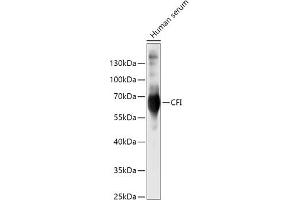 Western blot analysis of extracts of Human serum, using CFI antibody (ABIN6127713, ABIN6138461, ABIN6138462 and ABIN6221257) at 1:500 dilution. (Complement Factor I 抗体  (AA 19-300))