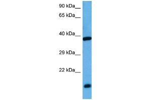 Host:  Rabbit  Target Name:  ATF4  Sample Tissue:  Mouse Kidney  Antibody Dilution:  1ug/ml (ATF4 抗体  (N-Term))