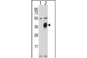Western blot analysis of PLAUR (arrow) using rabbit polyclonal PLAUR Antibody  (ABIN652429 and ABIN2842227). (PLAUR 抗体  (AA 136-166))