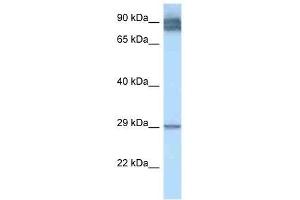 Western Blot showing LRAT antibody used at a concentration of 1. (LRAT 抗体  (N-Term))