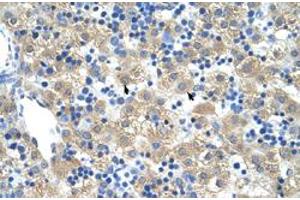 Immunohistochemical staining (Formalin-fixed paraffin-embedded sections) of human liver with FERD3L polyclonal antibody  at 4-8 ug/mL working concentration. (FERD3L 抗体  (N-Term))