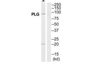 Western blot analysis of extracts from Jurkat cells, using PLG antibody.