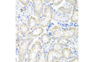 Immunohistochemistry of paraffin-embedded mouse kidney using SPICE1 antibody at dilution of 1:100 (x40 lens). (SPICE1 抗体)