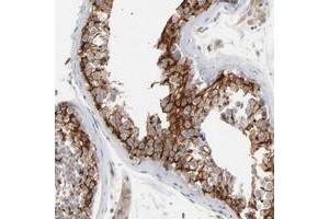 Immunohistochemical staining of human testis with ITPR3 polyclonal antibody  shows cytoplasmic positivity in cells in seminiferus ducts at 1:200-1:500 dilution. (ITPR3 抗体)
