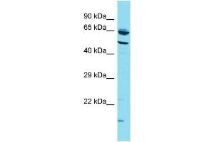 Host: Rabbit Target Name: CCZ1B Sample Type: HT1080 Whole Cell lysates Antibody Dilution: 1. (CCZ1B 抗体  (N-Term))