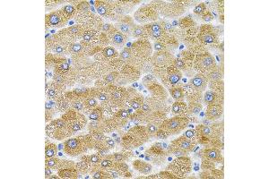 Immunohistochemistry of paraffin-embedded human liver injury using MFN2 antibody (ABIN6290636) (40x lens). (MFN2 抗体)