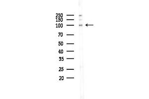 Western blot analysis of lysates from COLO205 cells(UV,30 min treatment), using MCM5 Antibody at 1/1000 dilution.