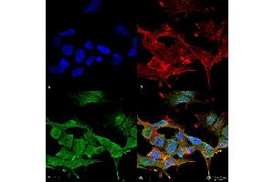 Immunocytochemistry/Immunofluorescence analysis using Mouse Anti-Clcn3 Monoclonal Antibody, Clone S258-5 . (CLCN3 抗体  (AA 98-115))
