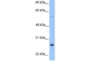 WB Suggested Anti-METTL7B Antibody Titration:  0. (METTL7B 抗体  (Middle Region))