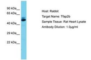 Image no. 1 for anti-Transcription Factor AP-2 beta (Activating Enhancer Binding Protein 2 Beta) (TFAP2B) (AA 104-153) antibody (ABIN6750458)