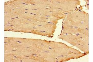 Immunohistochemistry of paraffin-embedded human skeletal muscle tissue using ABIN7167899 at dilution of 1:100 (RIPOR2 抗体  (AA 1-250))