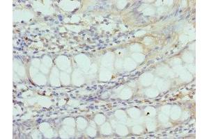 Immunohistochemistry of paraffin-embedded human colon tissue using ABIN7148825 at dilution of 1:100 (CNGA3 抗体  (AA 1-165))