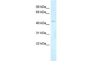 WB Suggested Anti-FOXN2 Antibody Titration: 1. (FOXN2 抗体  (Middle Region))
