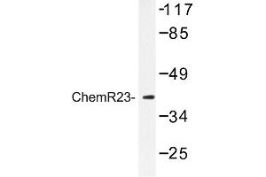 Image no. 1 for anti-Chemokine-Like Receptor 1 (CMKLR1) antibody (ABIN272278) (CMKLR1 抗体)
