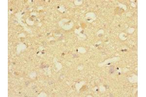 Immunohistochemistry of paraffin-embedded human brain tissue using ABIN7148481 at dilution of 1:100 (CNTNAP1 抗体  (AA 20-300))