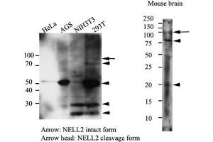 Western Blotting (WB) image for anti-NEL-Like 2 (Chicken) (NELL2) antibody (ABIN614304) (NELL2 抗体)