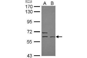 WB Image ELP3 antibody [N3C3] detects ELP3 protein by Western blot analysis. (ELP3/KAT9 抗体  (Center))