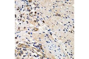 Immunohistochemistry (Paraffin-embedded Sections) (IHC (p)) image for anti-Minichromosome Maintenance Complex Component 2 (MCM2) (AA 360-700) antibody (ABIN3021315)