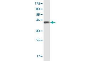 Western Blot detection against Immunogen (37. (TRPV1 抗体  (AA 21-124))