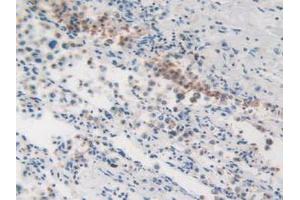 IHC-P analysis of Human Lung Tissue, with DAB staining.