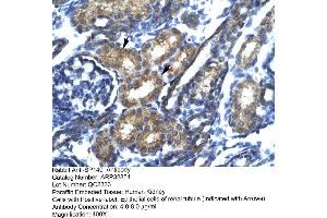 Immunohistochemistry (IHC) image for anti-SP140 Nuclear Body Protein (SP140) (N-Term) antibody (ABIN2777631) (SP140 抗体  (N-Term))