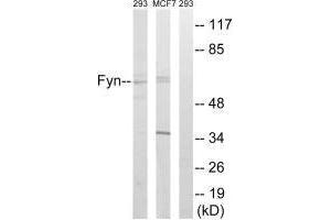 Western blot analysis of extracts from HUVEC cells, MCF-7 cells and 293 cells, using Fyn (Ab-530) antibody. (FYN 抗体  (Tyr530))