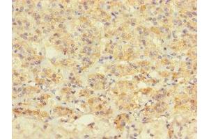 Immunohistochemistry of paraffin-embedded human adrenal gland tissue using ABIN7172677 at dilution of 1:100