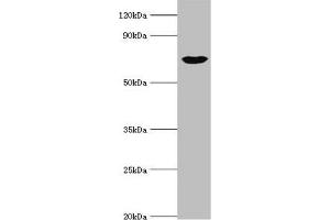 Western blot All lanes: cGMP-dependent protein kinase 1 antibody at 3 μg/mL + Mouse lung tissue Secondary Goat polyclonal to rabbit IgG at 1/10000 dilution Predicted band size: 77, 78, 45 kDa Observed band size: 77 kDa