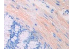 Detection of PGP in Mouse Colon Tissue using Polyclonal Antibody to Phosphoglycolate Phosphatase (PGP)